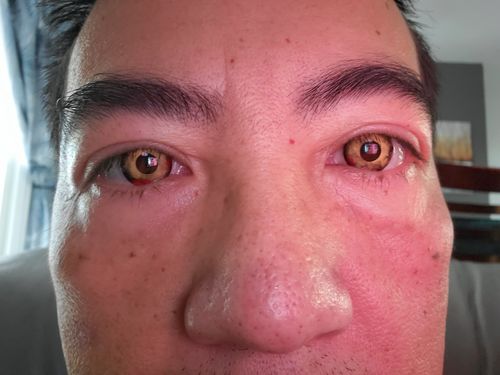 PRIMAL Walking Dead I lentilles jaunes rouges